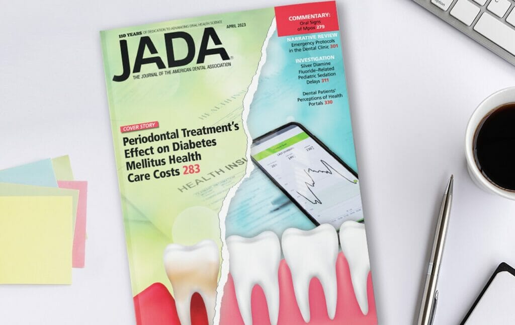 April JADA finds periodontal treatment may reduce health care costs for patients with diabetes